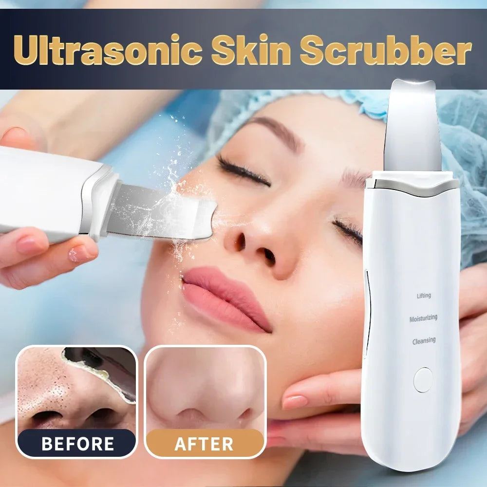 Professional Ultrasonic Skin Scrubber & Peeler